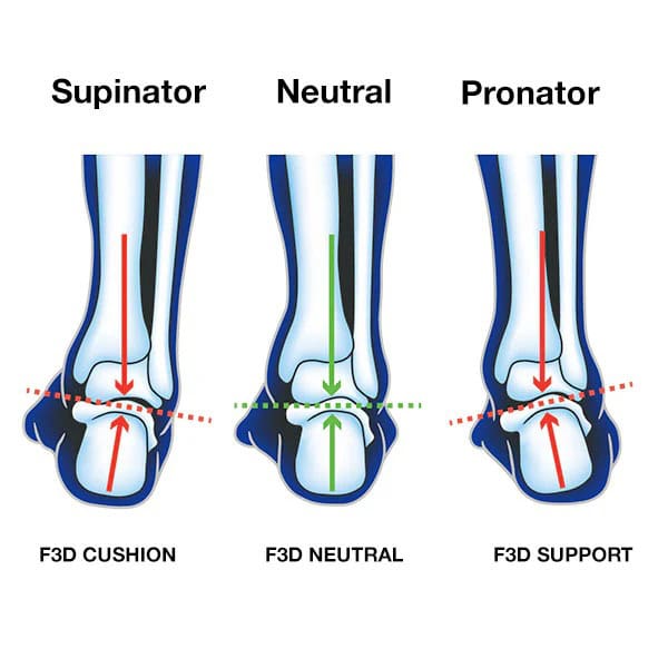 UP Medical Advanced F3D Neutral Insole 2
